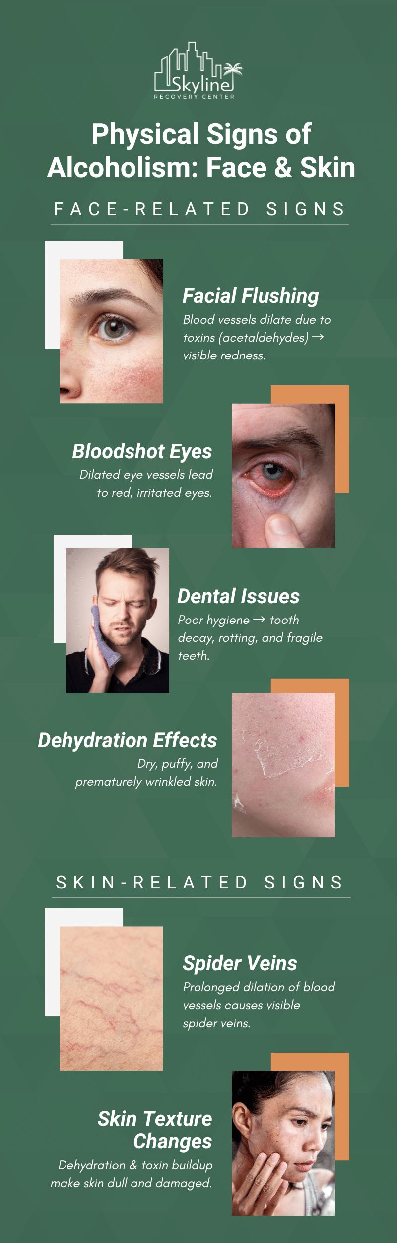 **Alt text:** Infographic on face and skin signs of alcoholism, like redness, bloodshot eyes, and skin damage. 